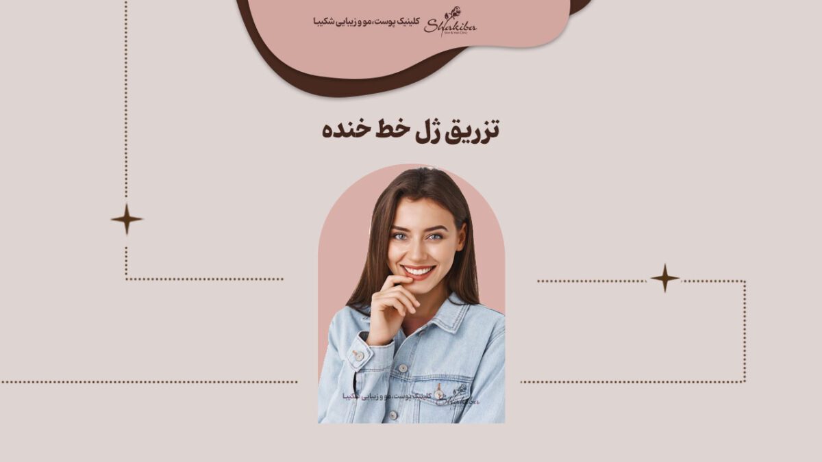 تزریق ژل خط خنده