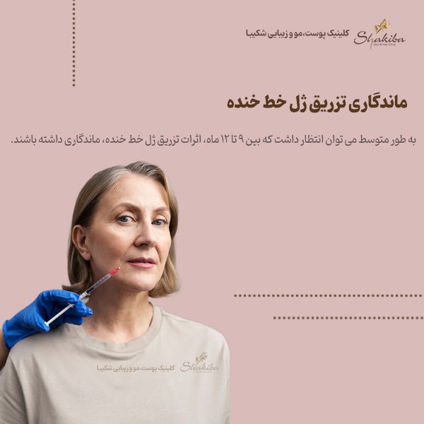 ماندگاری تزریق ژل خط خنده