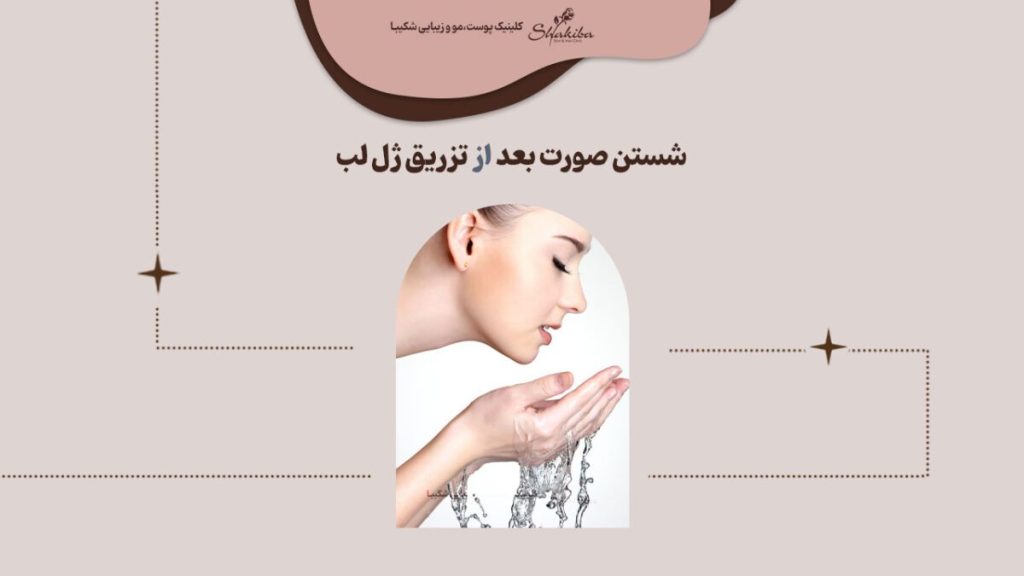 نحوه شستن صورت بعد از تزریق ژل لب