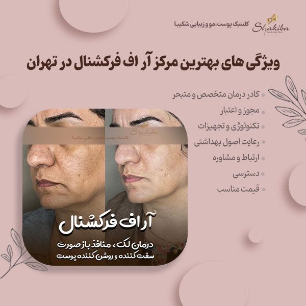 ویژگی های بهترین مرکز آر اف فرکشنال در تهران