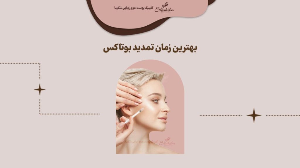 بهترین زمان تمدید بوتاکس