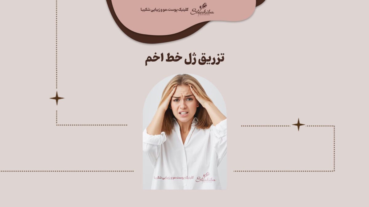 تزریق ژل خط اخم
