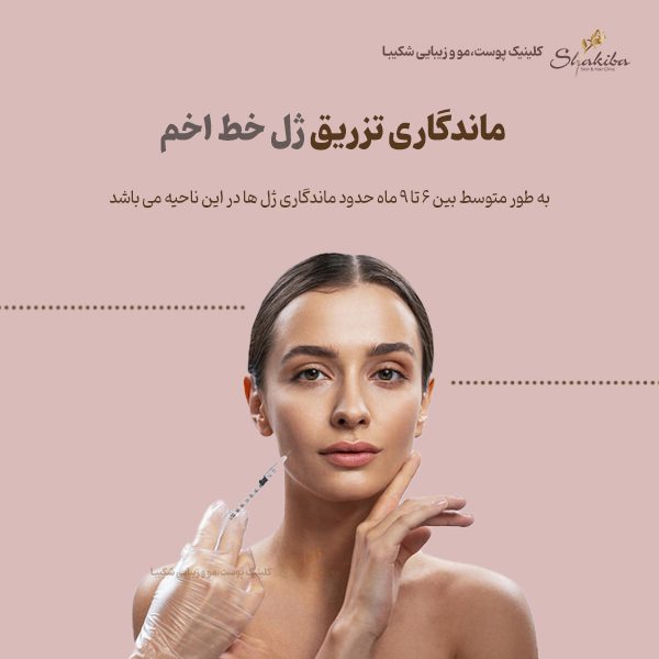 ماندگاری تزریق ژل خط اخم