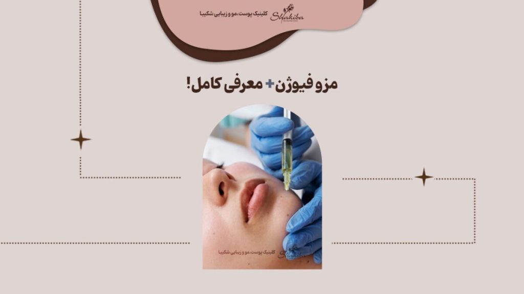 مزو فیوژن