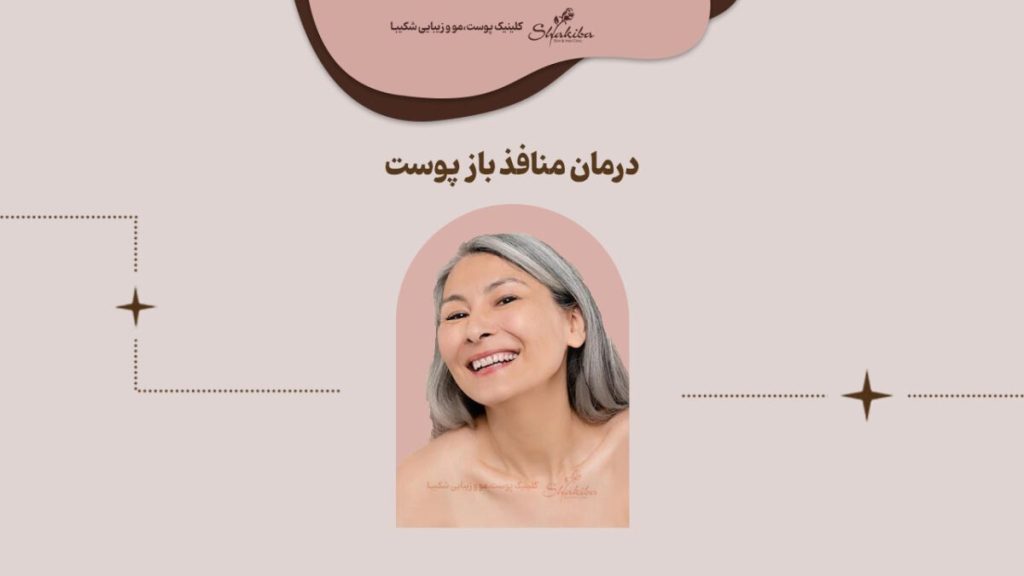 درمان منافذ باز پوست