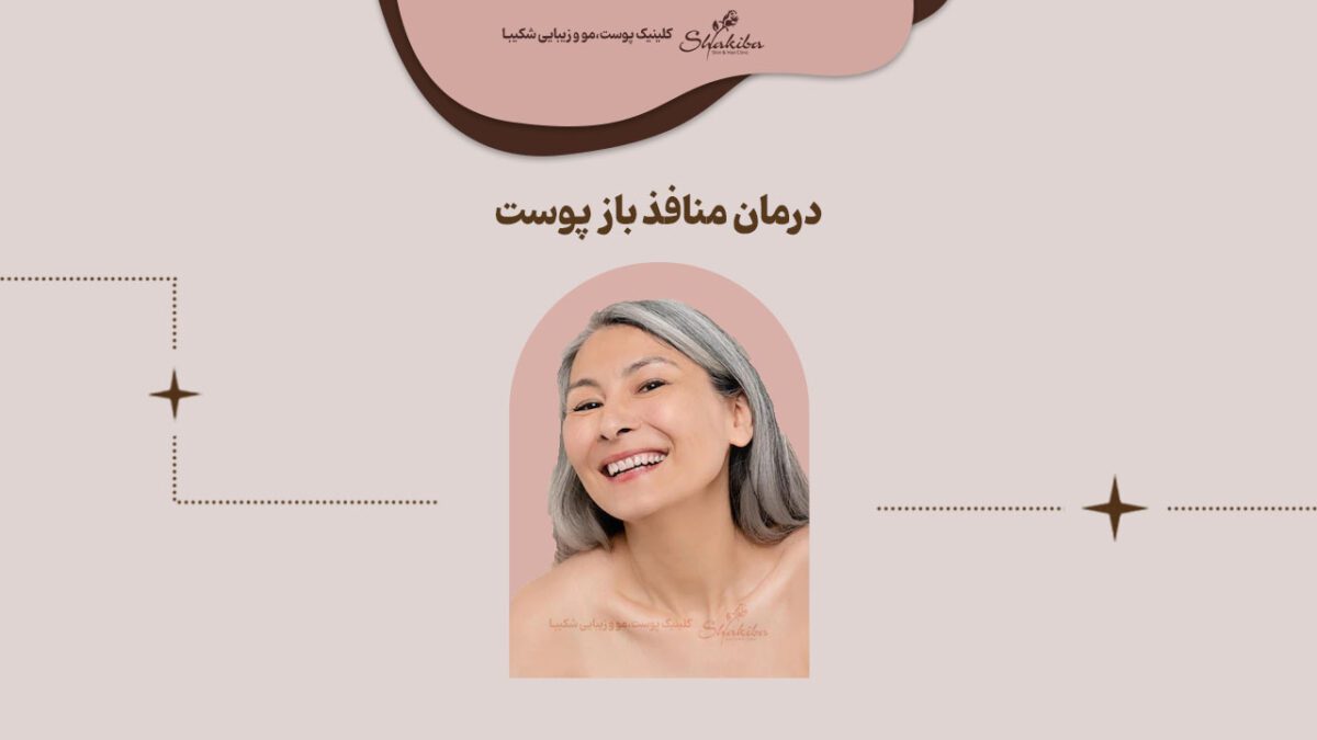 درمان منافذ باز پوست