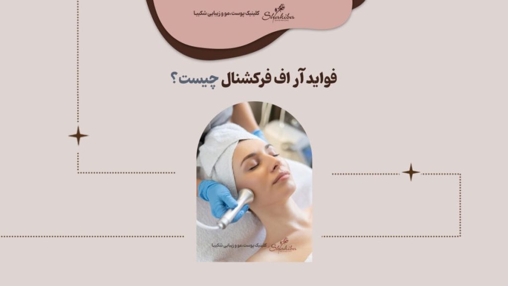 فواید آر اف فرکشنال چیست
