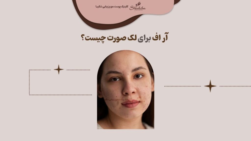 آر اف برای لک صورت چیست