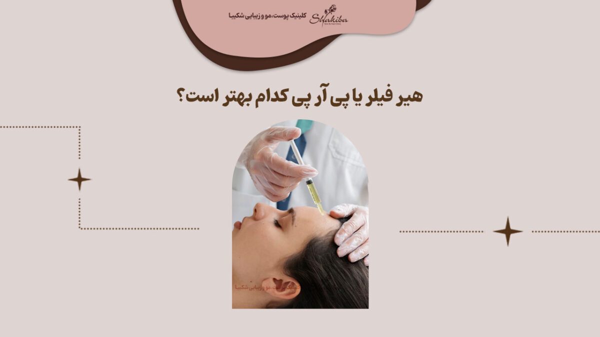 هیر فیلر یا پی آر پی