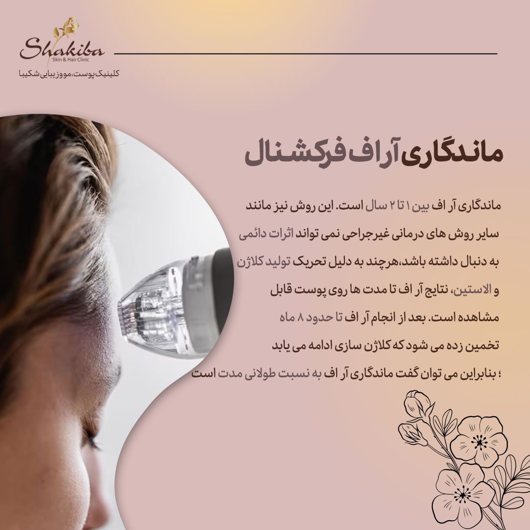 ماندگاری آر اف فرکشنال
