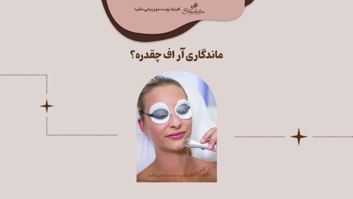 ماندگاری آر اف چقدره