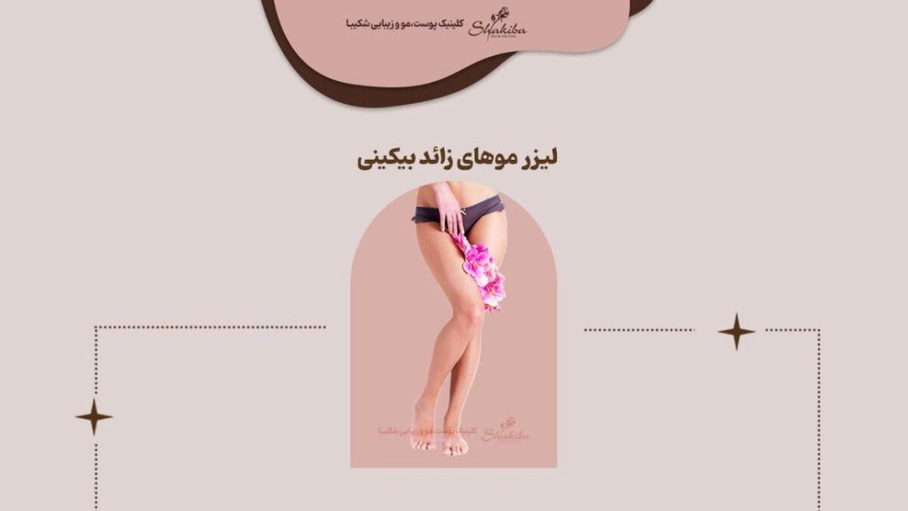 لیزر موهای زائد بیکینی