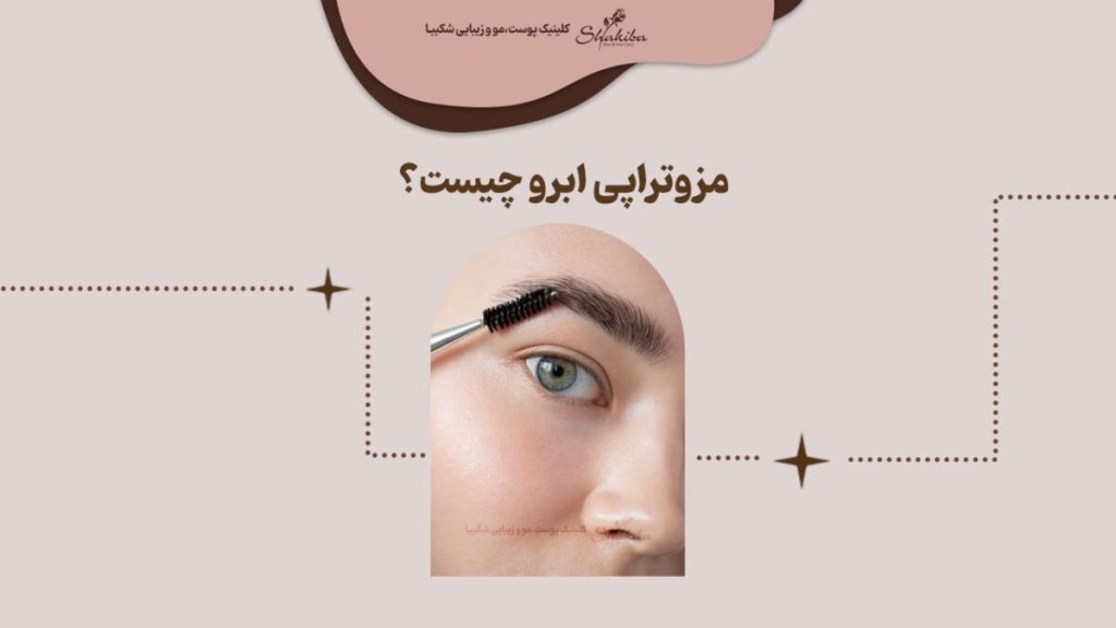 مزوتراپی ابرو چیست