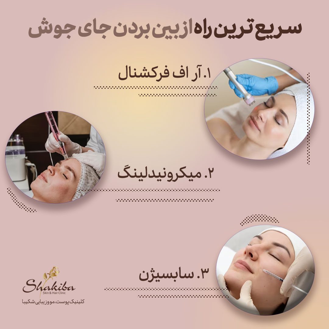از بین بردن جای جوش