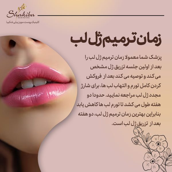 زمان ترمیم ژل لب