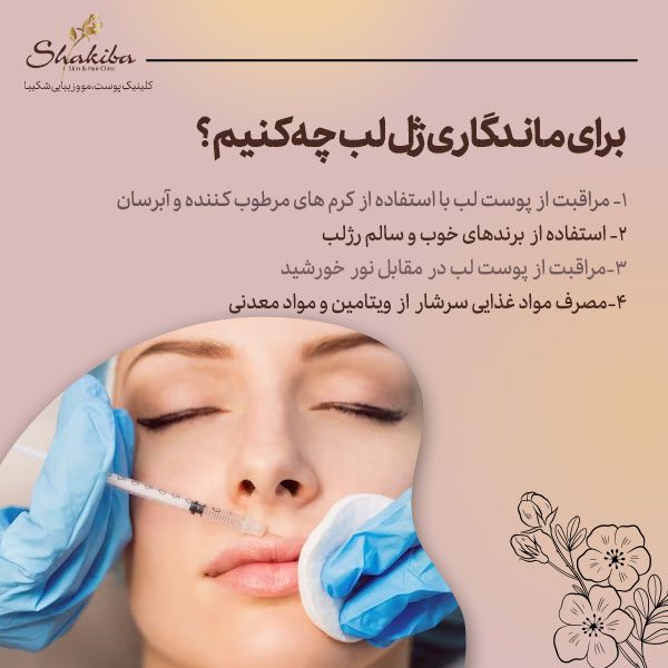 ماندگاری ژل لب