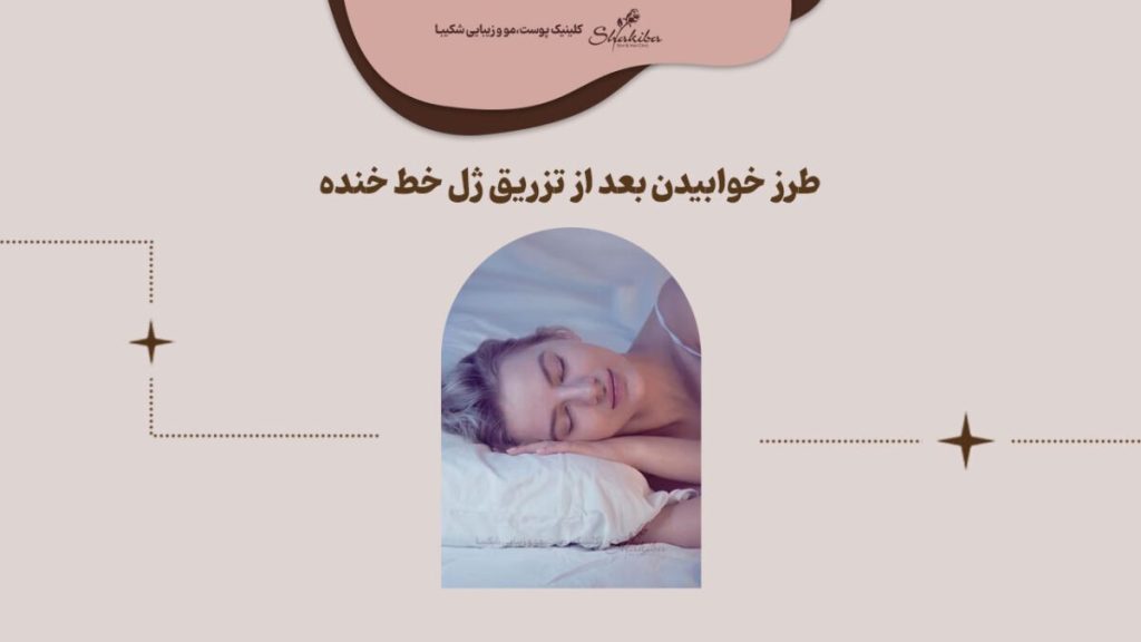 خوابیدن بعد از تزریق ژل خط خنده