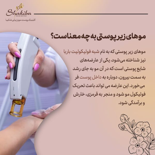 موهای زیر پوستی