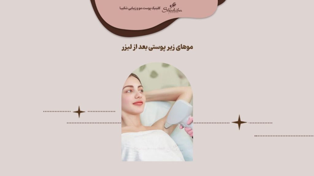 درمان موهای زیر پوستی بعد از لیزر