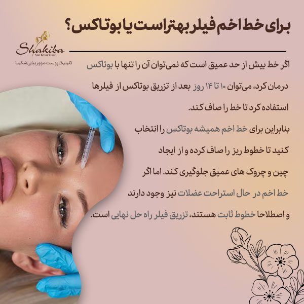  فیلر بهتر است یا بوتاکس