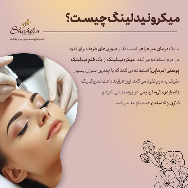 میکرونیدلینگ چیست