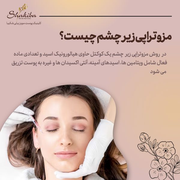 مزوتراپی زیر چشم چیست