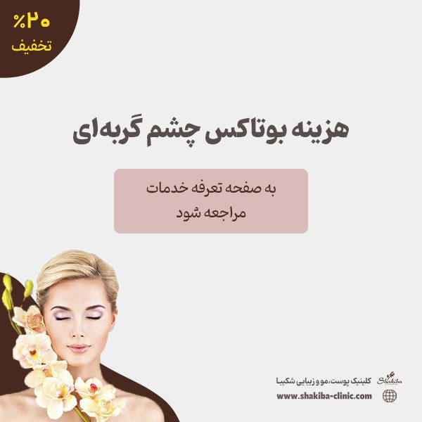 هزینه بوتاکس چشم گربه ای