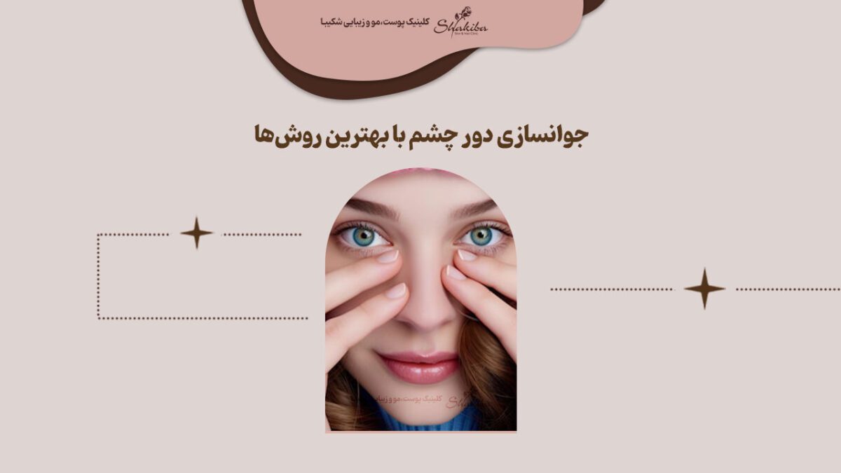 جوانسازی دور چشم با بهترین روش‌ها