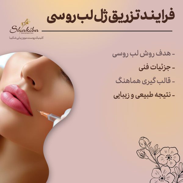 فرایند تزریق ژل لب روسی