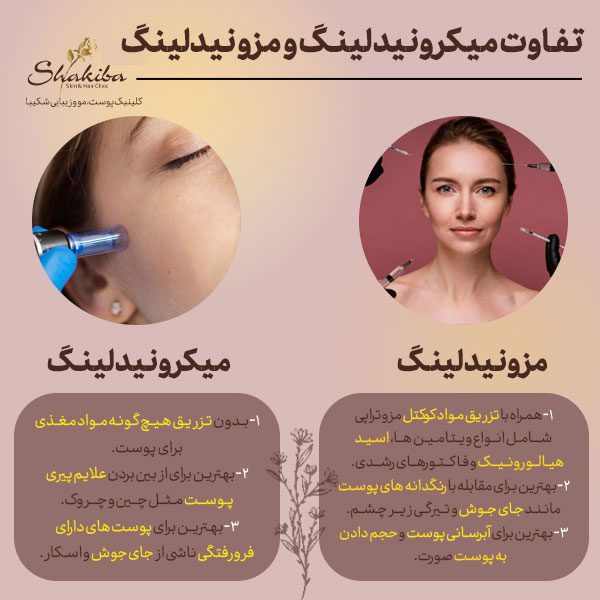 تفاوت میکرونیدلینگ و مزونیدلینگ