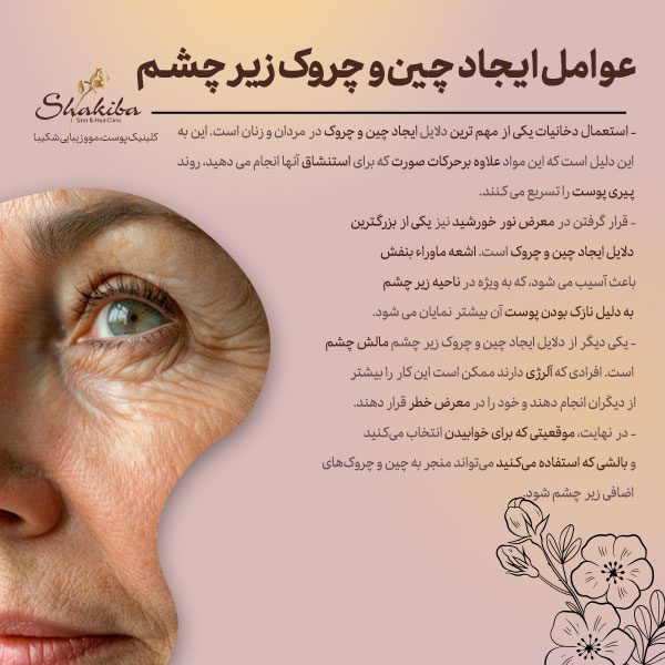 عوامل ایجاد چین و چروک زیر چشم