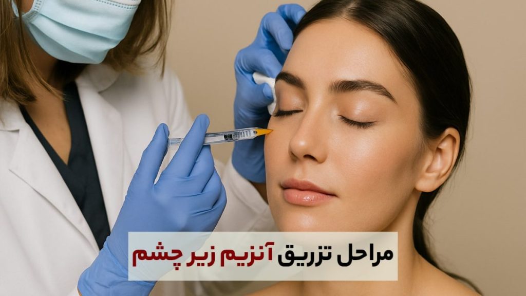 مراحل تزریق آنزیم برای زیر چشم