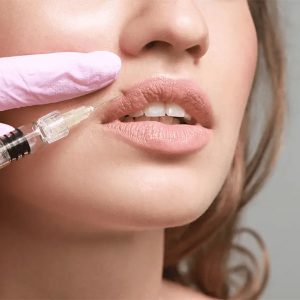 قیمت فیلر لب استایلج فرانسه