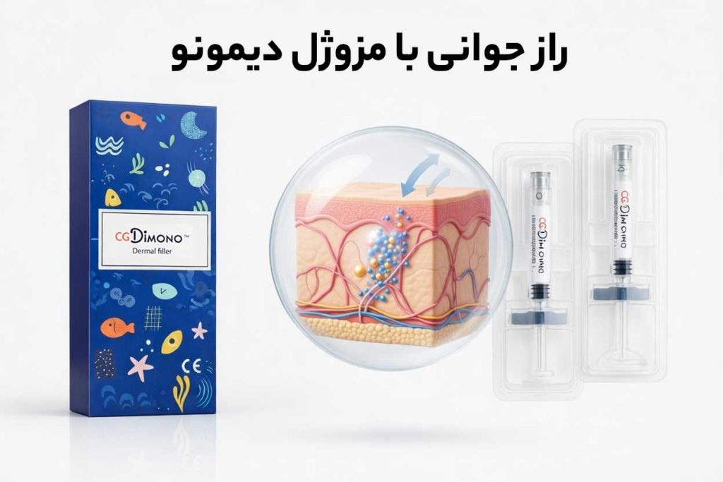 مزوژۀ دیمونو